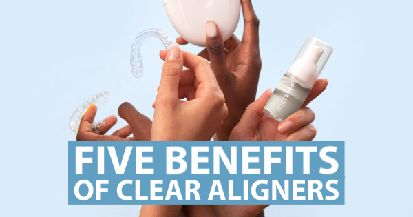 5 Benefits Of Clear Aligners
