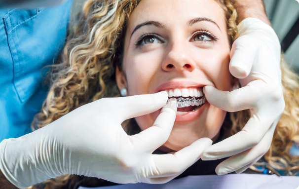RECEIVE YOUR ALIGNERS