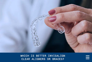 Which is Better Invisalign Clear Aligners or Braces?