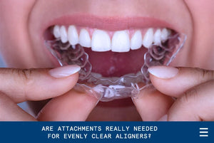 Are Attachments Really Needed for Evenly Clear Aligners?